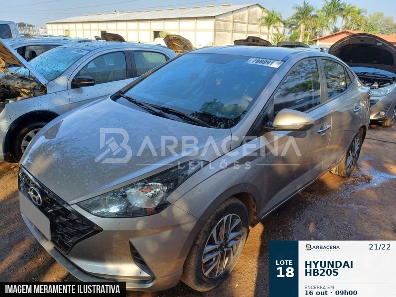 HYUNDAI HB20S 21/22